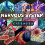 Nervous System Diseases Explained – Causes, Symptoms, & Treatments