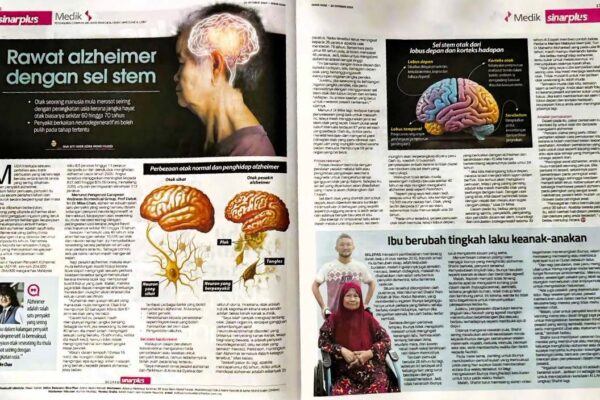 Sinar Harian Report: Prof Mike Chan’s Groundbreaking Alzheimer’s Research